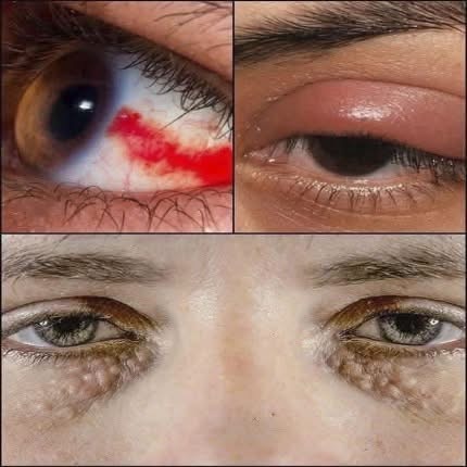 OJO: Estas señales en tus ojos podrían alertar enfermedades graves antes de que sea demasiado tarde