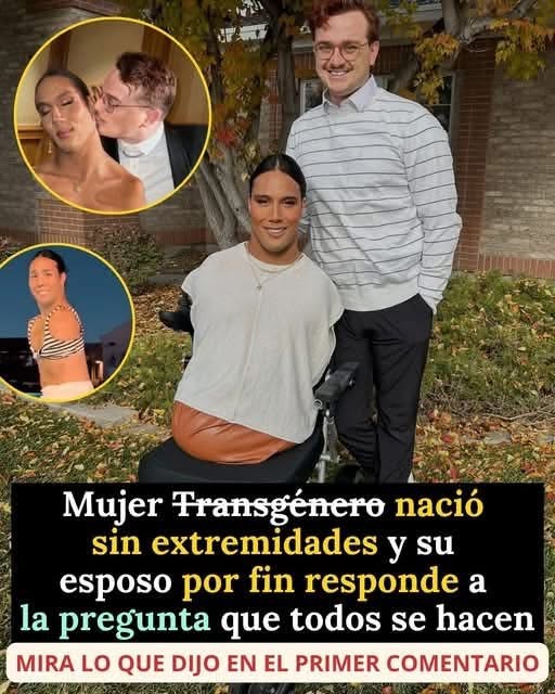 Mujer Trans Sin Extremidades Se Vuelve Viral Y Su Historia Conmueve A Internet