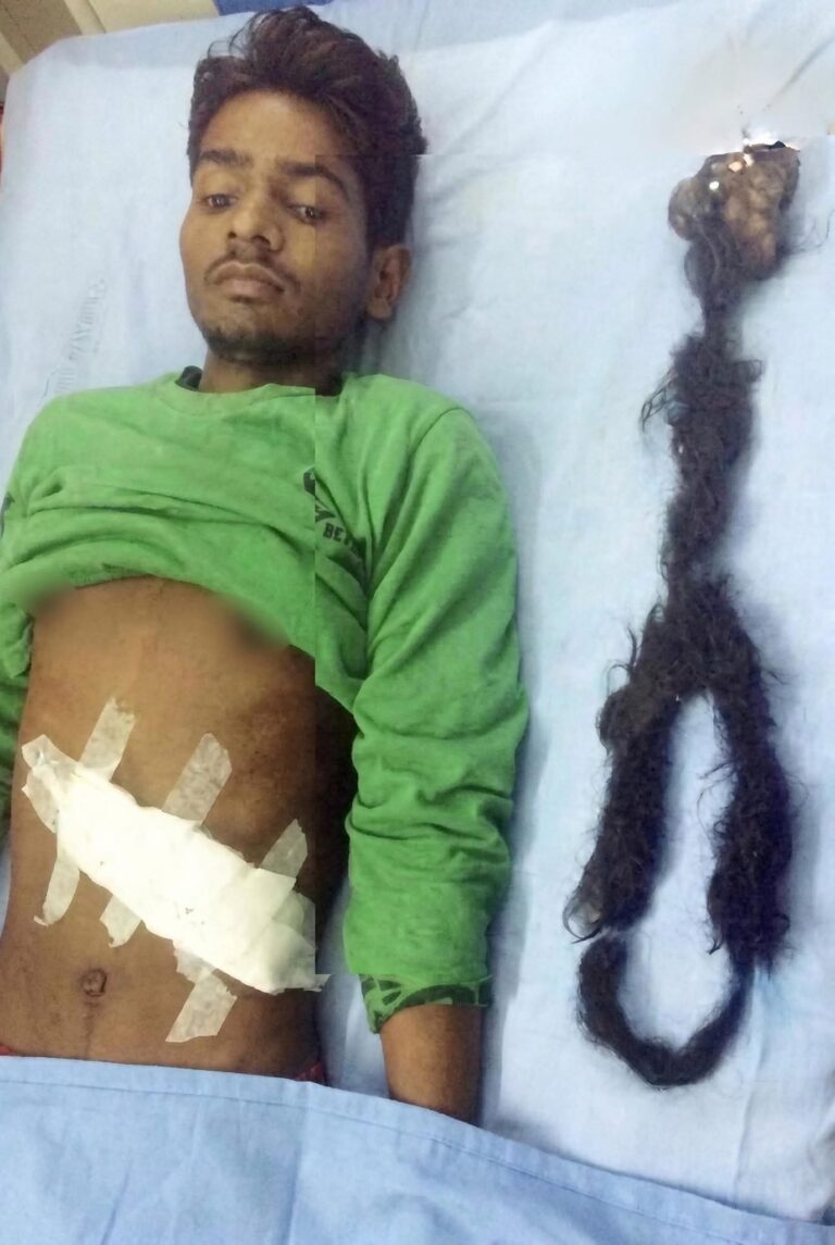 😨 Lo que encontraron dentro de su cuerpo dejó impactados a los médicos