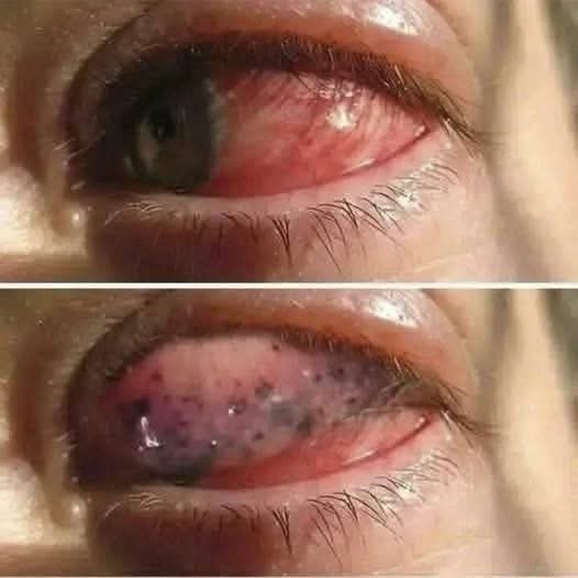 😨 Las consecuencias para los ojos al dormir de forma incorrecta o incómoda