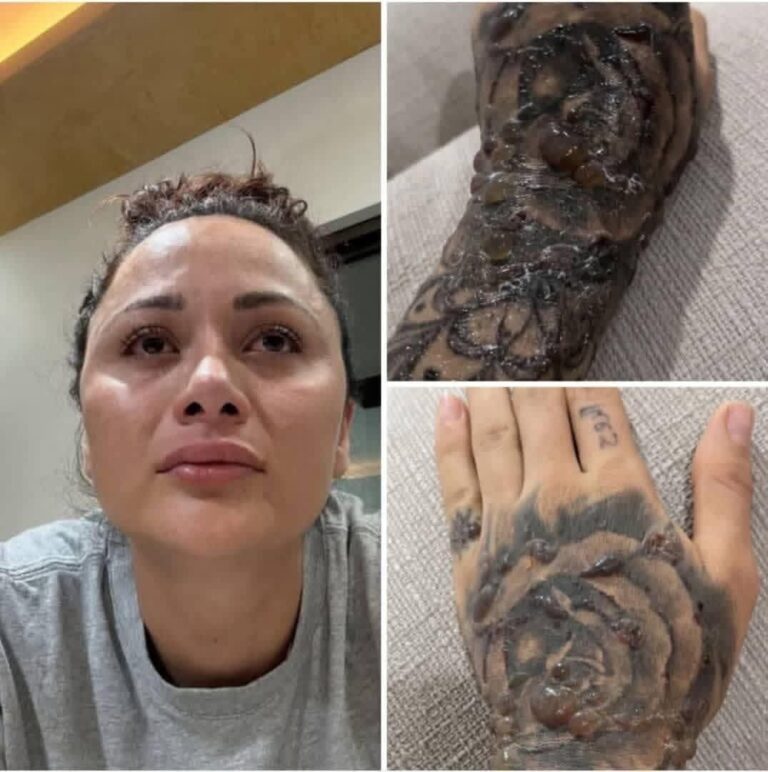 😱 Lo que parecía un tatuaje normal terminó convirtiéndose en una pesadilla que impacta en redes