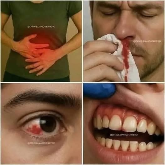 🚨 Estos son los signos que podrían alertar sobre una grave enfermedad en la sangre