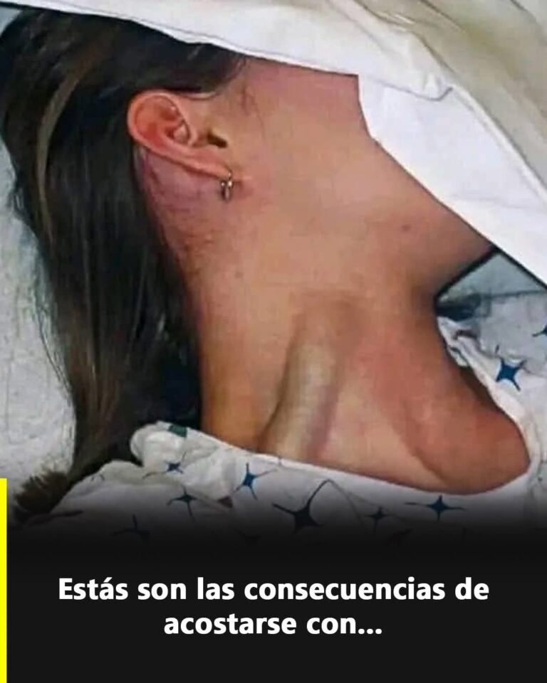 ⚠️ Ingurgitación yugular: la señal en el cuello que no debes ignorar