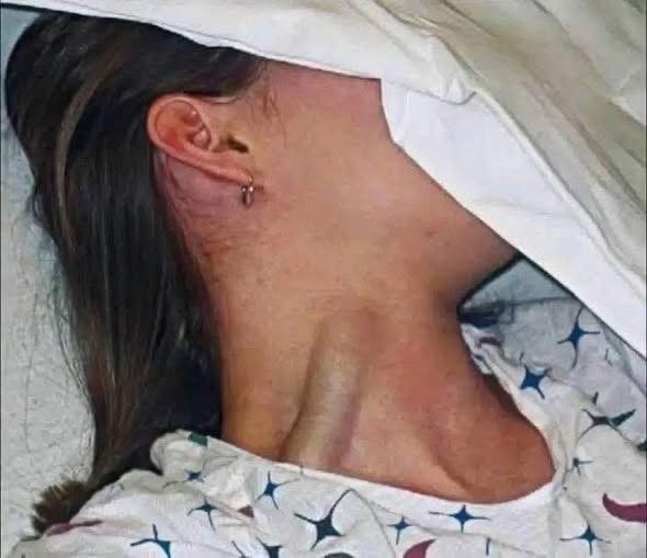 Lo que parecía una simple vena inflamada terminó encendiendo una alerta sobre la salud
