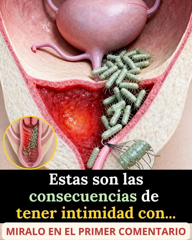 Infecciones íntimas: señales, síntomas y cuándo debes prestar atención